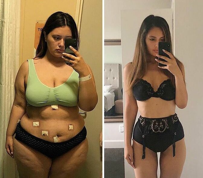 Mädchen vor und nach Gewichtsverlust mit Kapseln KETO Complete